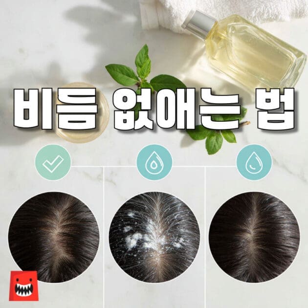 비듬 샴푸 추천, 두피 각질 및 비듬 고민 케어, 머리 청결 관리와 산뜻한 세정감 강조 이미지
